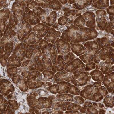 Immunohistochemistry-Paraffin: TMEM109 Antibody [NBP1-93462]