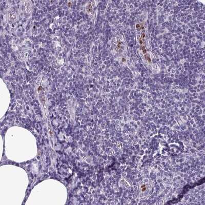 Immunohistochemistry-Paraffin: TMEM11 Antibody [NBP2-13443]