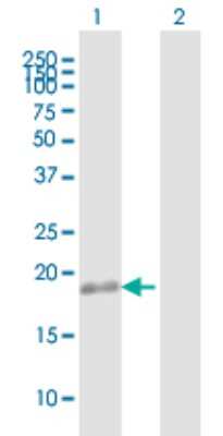 Western Blot: TMEM11 Antibody [H00008834-B01P]