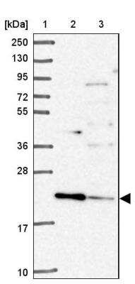 Western Blot: TMEM11 Antibody [NBP2-13443]