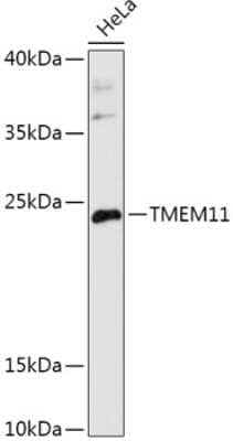 Western Blot: TMEM11 AntibodyAzide and BSA Free [NBP2-93465]