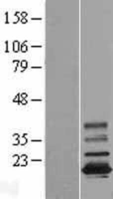 Western Blot: TMEM11 Overexpression Lysate [NBL1-16998]