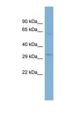 Western Blot: TMEM110 Antibody [NBP1-69238]