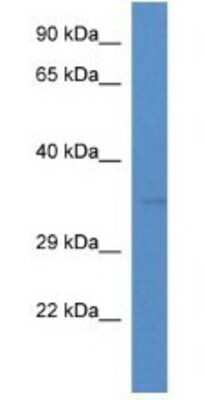 Western Blot: TMEM110 Antibody [NBP1-74232]