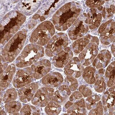 Immunohistochemistry-Paraffin: TMEM110-MUSTN1 Antibody [NBP2-14747]