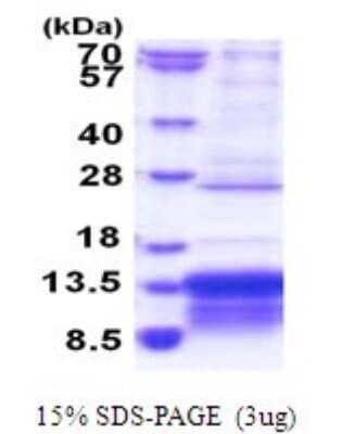 SDS-PAGE: Recombinant Human MUSTN1 His Protein [NBP2-51790]