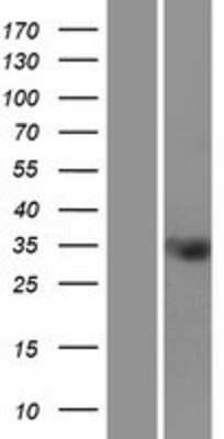 Western Blot: TMEM110 Overexpression Lysate [NBP2-04682]