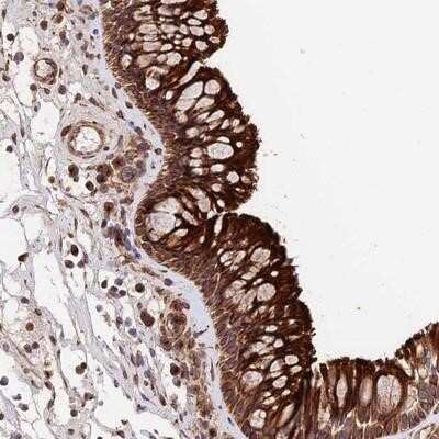 Immunohistochemistry-Paraffin: TMEM111 Antibody [NBP1-86216]