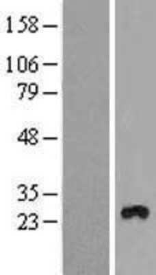 Western Blot: TMEM111 Overexpression Lysate [NBL1-17000]