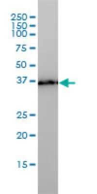 Western Blot: TMEM115 Antibody (3D4) [H00011070-M01]