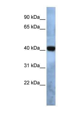 Western Blot: TMEM115 Antibody [NBP1-62560]