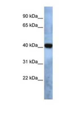 Western Blot: TMEM115 Antibody [NBP1-69572]