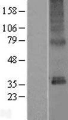 Western Blot: TMEM115 Overexpression Lysate [NBP2-07540]