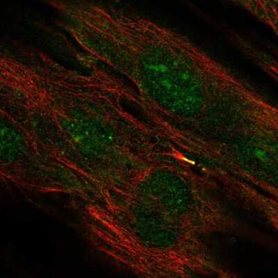 Immunocytochemistry/ Immunofluorescence: TMEM117 Antibody [NBP2-68637]