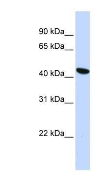 Western Blot: TMEM117 Antibody [NBP1-91358]