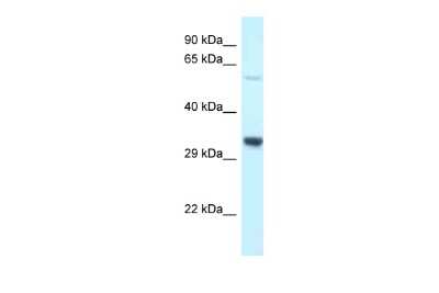 Western Blot: TMEM117 Antibody [NBP2-88439]