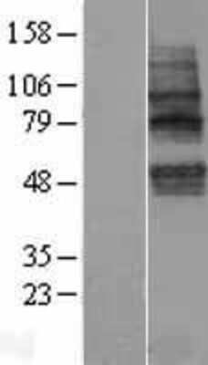 Western Blot: TMEM117 Overexpression Lysate [NBP2-06058]