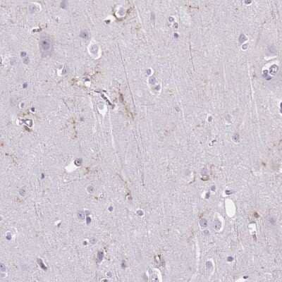 Immunohistochemistry-Paraffin: TMEM119 Antibody [NBP2-30551]