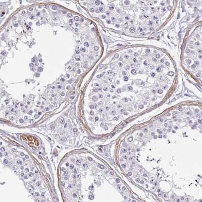 Immunohistochemistry-Paraffin: TMEM119 Antibody [NBP2-30551]