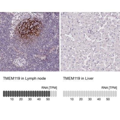 Immunohistochemistry-Paraffin: TMEM119 Antibody [NBP2-30551]