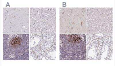 Immunohistochemistry-Paraffin: TMEM119 Antibody [NBP2-30551]
