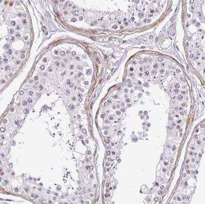 Immunohistochemistry-Paraffin: TMEM119 Antibody [NBP2-30792]
