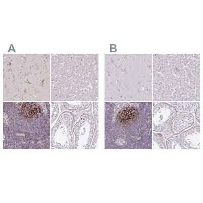 Immunohistochemistry-Paraffin: TMEM119 Antibody [NBP2-30792]