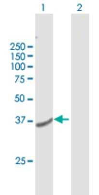 Western Blot: TMEM120A Antibody [H00083862-B01P]