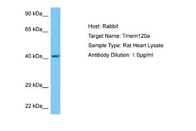 Western Blot: TMEM120A Antibody [NBP2-84304]