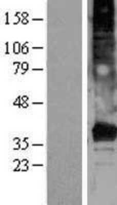 Western Blot: TMEM120A Overexpression Lysate [NBL1-17003]