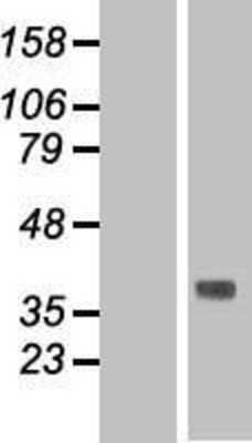 Western Blot: TMEM120B Overexpression Lysate [NBP2-08410]