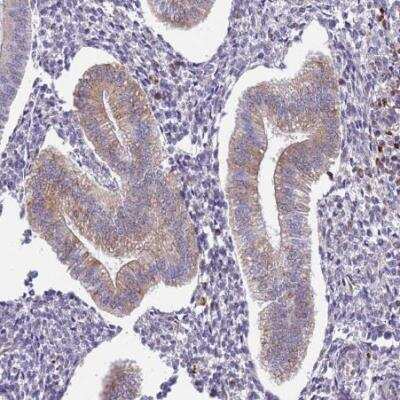 Immunohistochemistry-Paraffin: TMEM121 Antibody [NBP2-14693]