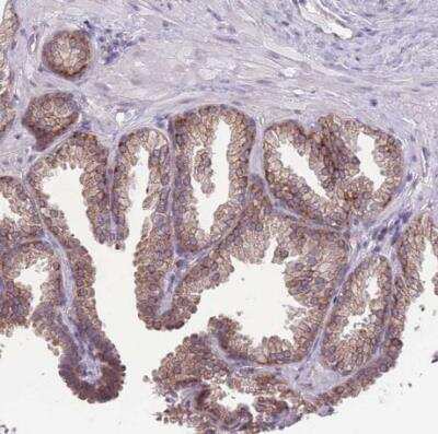 Immunohistochemistry-Paraffin: TMEM121 Antibody [NBP2-14693]