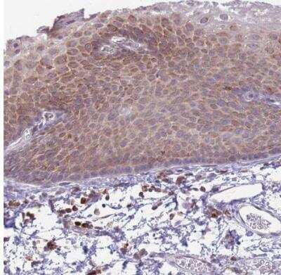 Immunohistochemistry-Paraffin: TMEM121 Antibody [NBP2-14693]