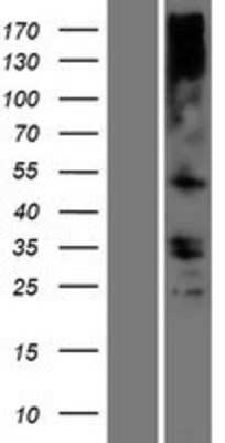 Western Blot: TMEM121 Overexpression Lysate [NBP2-06224]