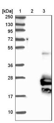 Western Blot: TMEM125 Antibody [NBP1-81186]