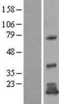 Western Blot: TMEM125 Overexpression Lysate [NBL1-17005]