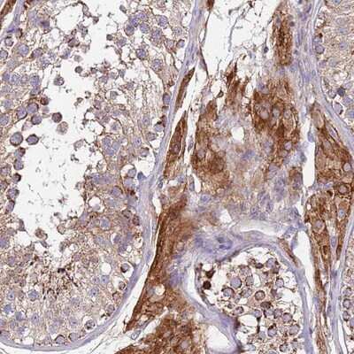 Immunohistochemistry-Paraffin: TMEM126A Antibody [NBP2-13444]