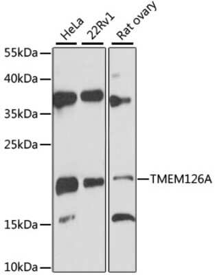 Western Blot: TMEM126A AntibodyAzide and BSA Free [NBP2-93371]