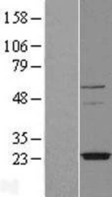 Western Blot: TMEM126A Overexpression Lysate [NBL1-17006]