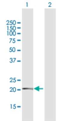 Western Blot: TMEM126B Antibody [H00055863-D01P]