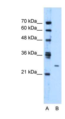 Western Blot: TMEM126B Antibody [NBP1-59978]