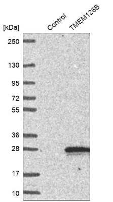 Western Blot: TMEM126B Antibody [NBP1-83157]