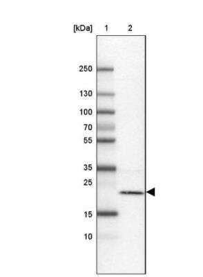 Western Blot: TMEM126B Antibody [NBP1-83158]