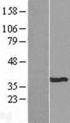 Western Blot: TMEM126B Overexpression Lysate [NBP2-06792]