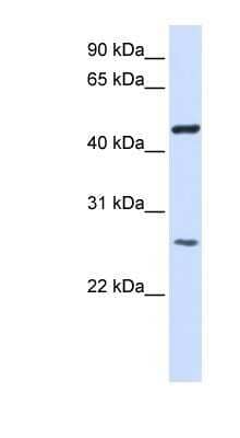 Western Blot: TMEM127 Antibody [NBP1-91305]