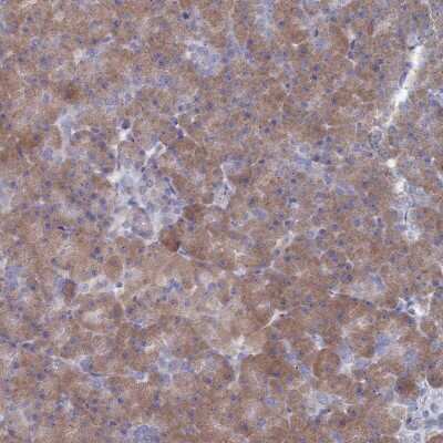 Immunohistochemistry-Paraffin: TMEM128 Antibody [NBP1-92516]