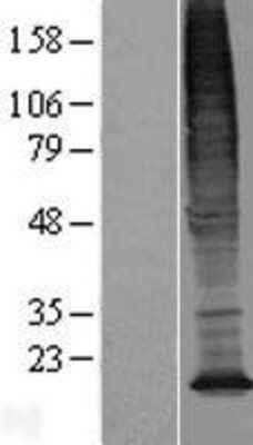 Western Blot: TMEM128 Overexpression Lysate [NBL1-17008]