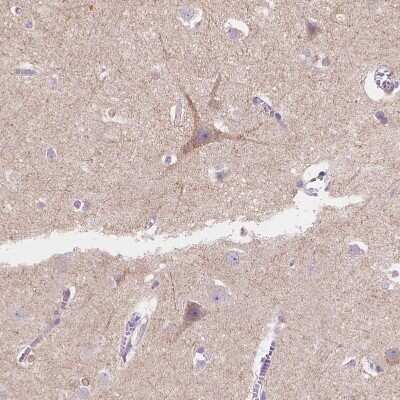 Immunohistochemistry-Paraffin: TMEM130 Antibody [NBP1-84099]