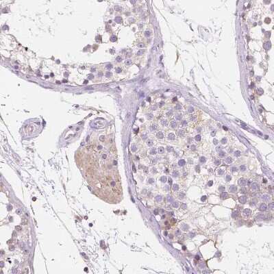 Immunohistochemistry-Paraffin: TMEM130 Antibody [NBP1-84099]